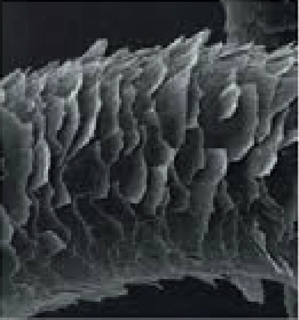 ダメージを受けた髪の表面を写した顕微鏡写真